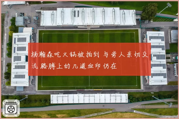 杨瀚森吃火锅被拍到 与旁人亲切交流 胳膊上的几道血印仍在