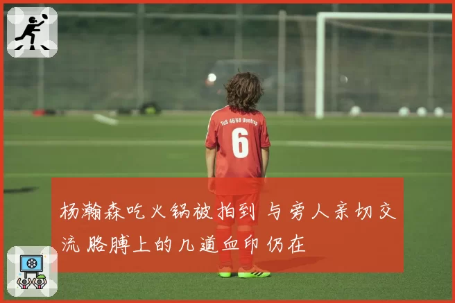 杨瀚森吃火锅被拍到 与旁人亲切交流 胳膊上的几道血印仍在